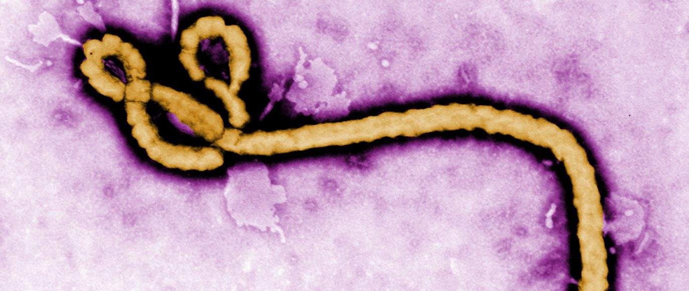 Ebola Virus.