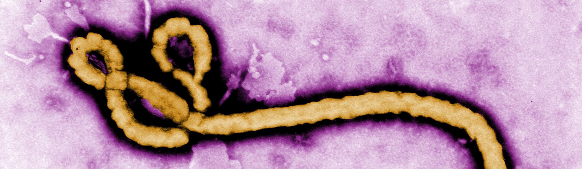Ebola-Virus.
