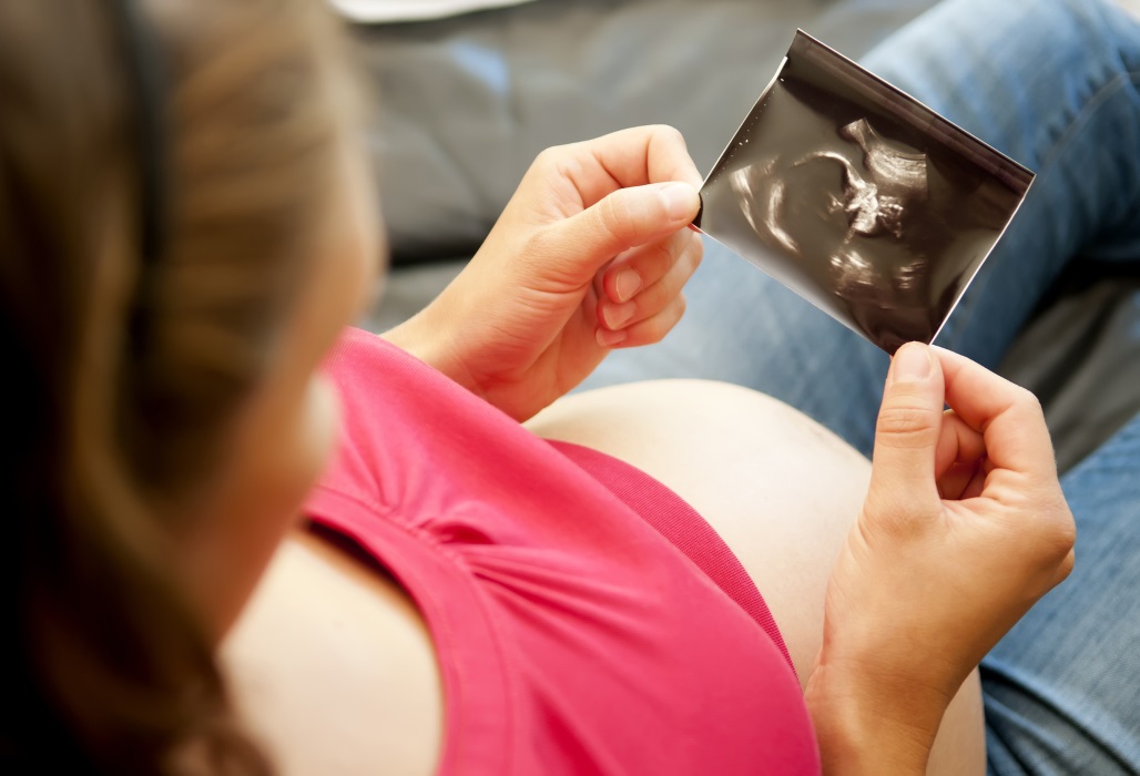 Schwangere Frau betrachtet Ultraschallbild.