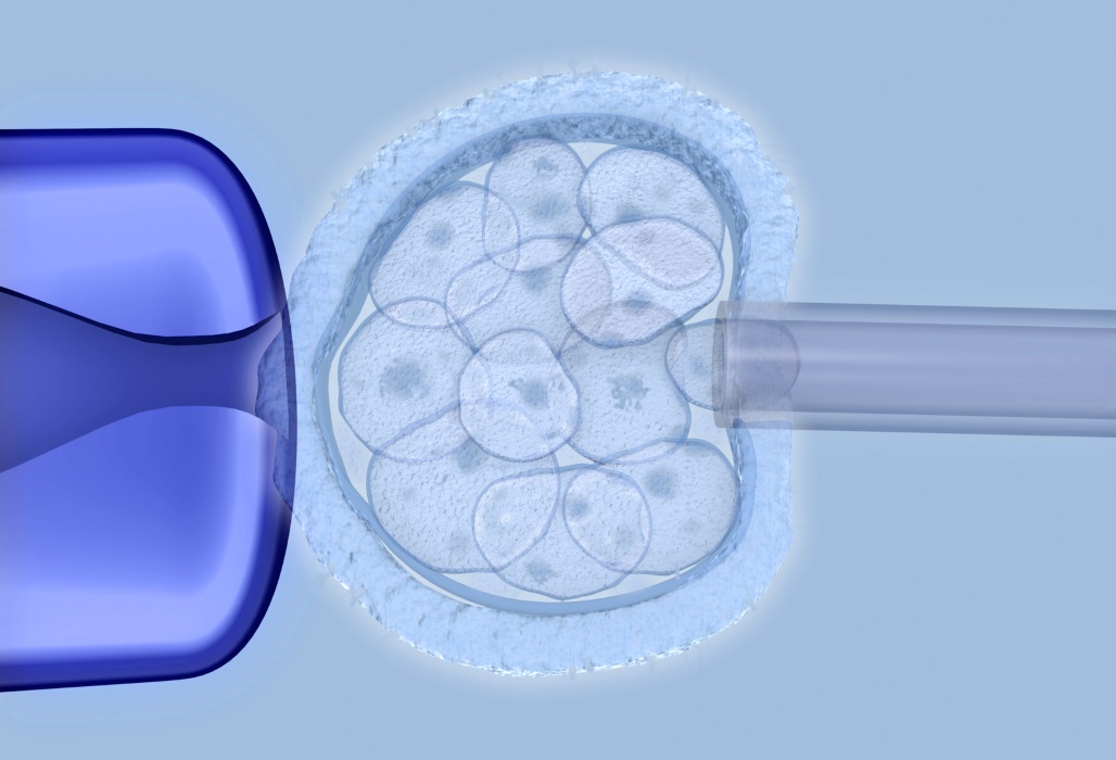 Invitro-Fertilisation - Befruchtung einer Eizelle.